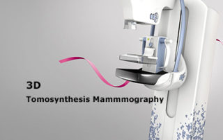 guidebook 3d mammography