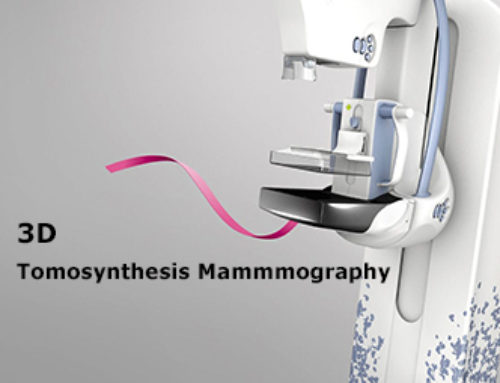3D tomosynthesis mammography Guidebook and Sinomdt XP300